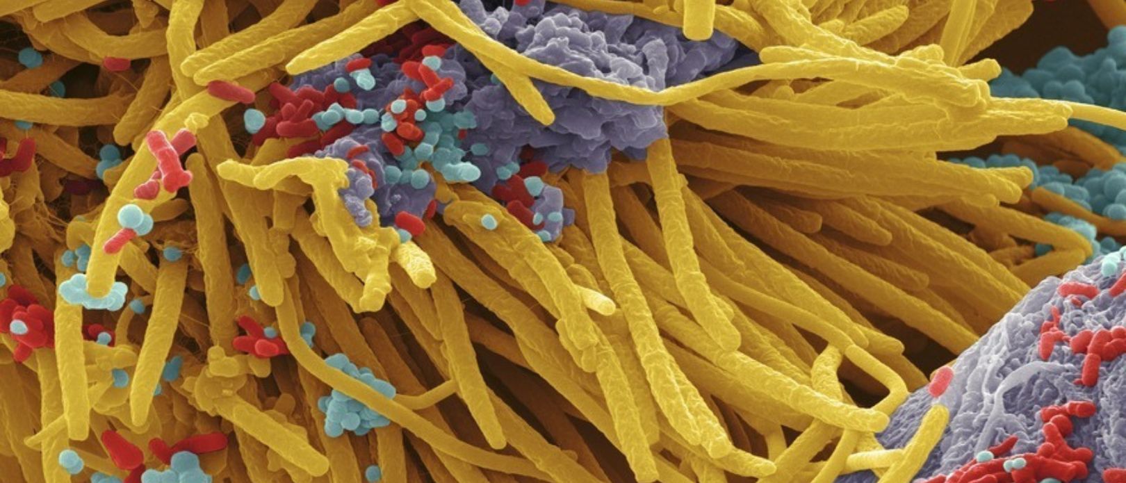 Coloured scanning electron micrograph (SEM) of mixed oral bacteria.